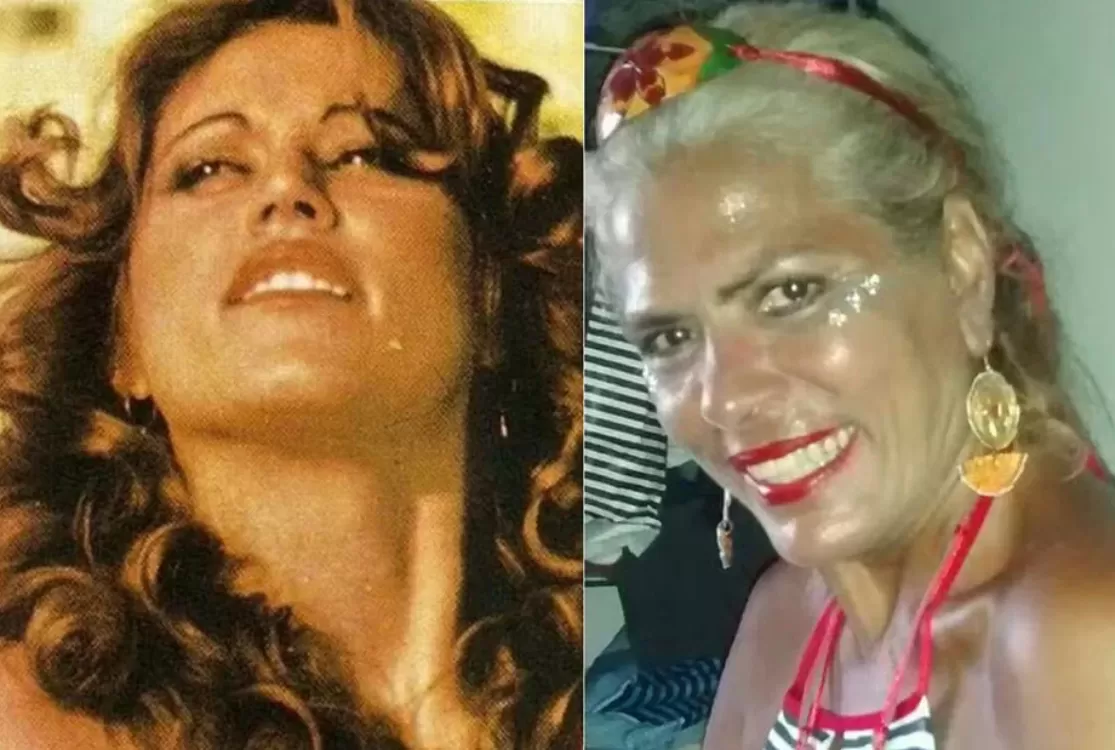 Ex-chacrete morre após um mês internada por ataque de pitbull do filho